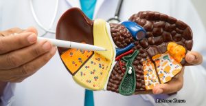 GNN New Blood Test Score Detects Hidden Alcohol Related Liver Disease