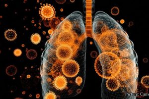 GNN Respiratory Virus HMPV Spreads Across Northern California and Multiple Regions