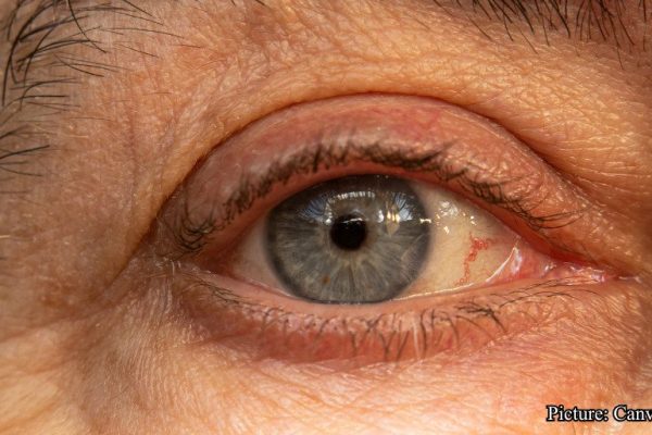 GNN Study Identifies Key Turning Point in Human Aging Around Age 50